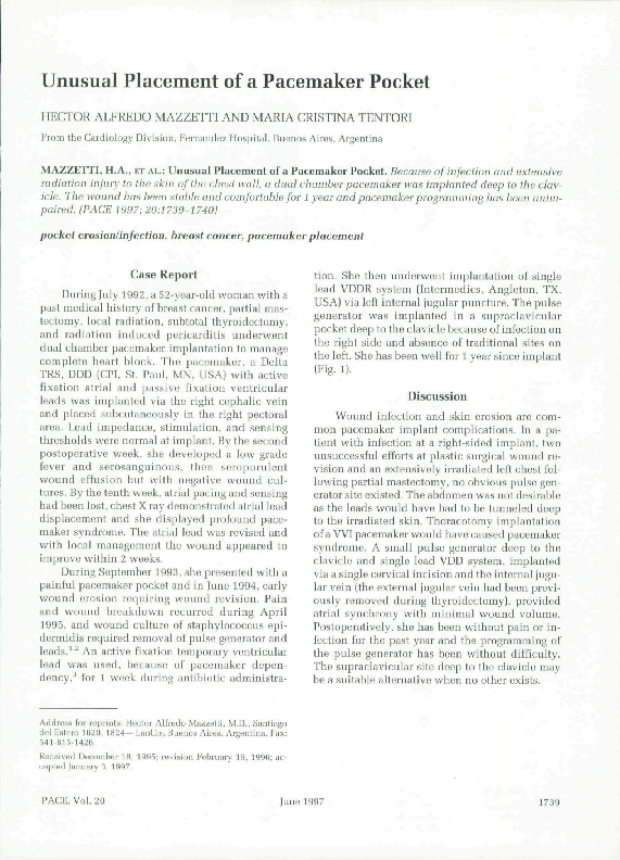 (PDF) Unusual Placement of a Pacemaker Pocket