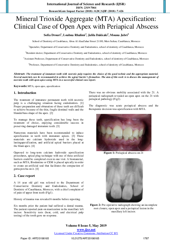 (PDF) Mineral Trioxide Aggregate ( MTA ) Apexification : Clinical Case ...