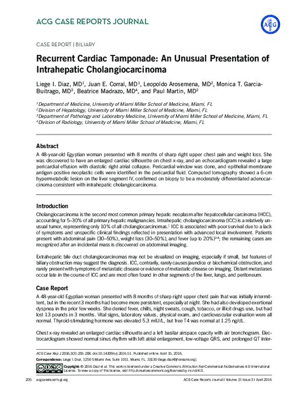  PDF Recurrent Cardiac Tamponade An Unusual Presentation Of 