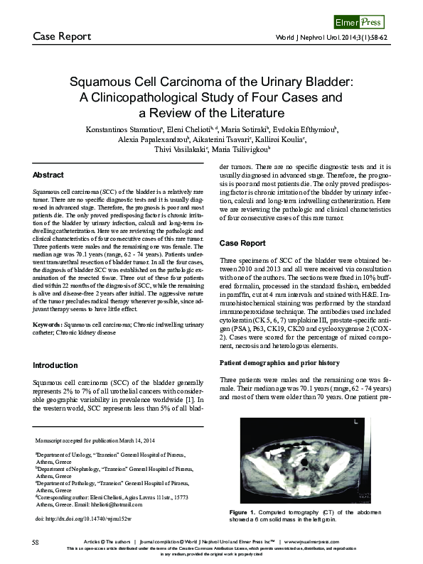 (PDF) Squamous cell carcinoma of the urinary bladder. Clinico ...