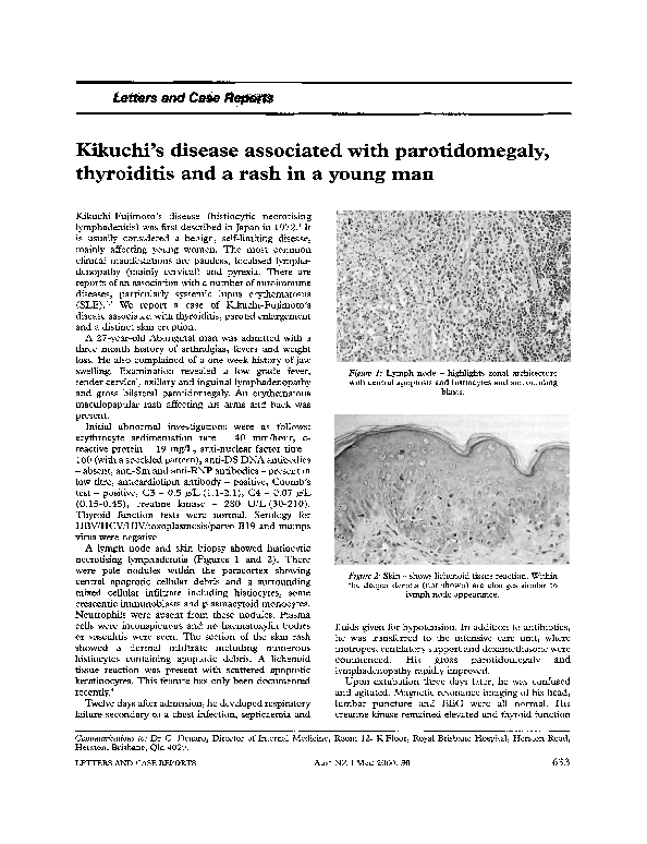 (PDF) Kikuchi's disease associated with parotidomegaly, thyroiditis and ...