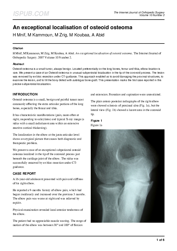(PDF) An exceptional localisation of osteoid osteoma