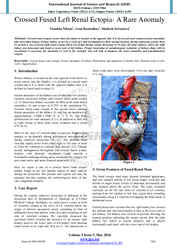 (PDF) Crossed Fused Left Renal Ectopia A Rare Anomaly Arun Karmalkar Academia.edu