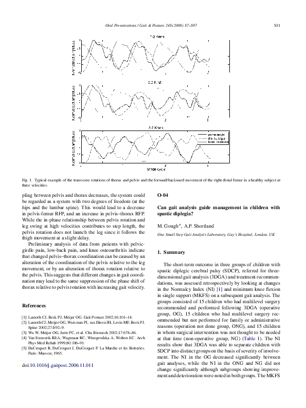 (PDF) Can gait analysis guide management in children with spastic diplegia?
