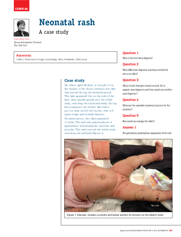(PDF) Neonatal rash - a case study