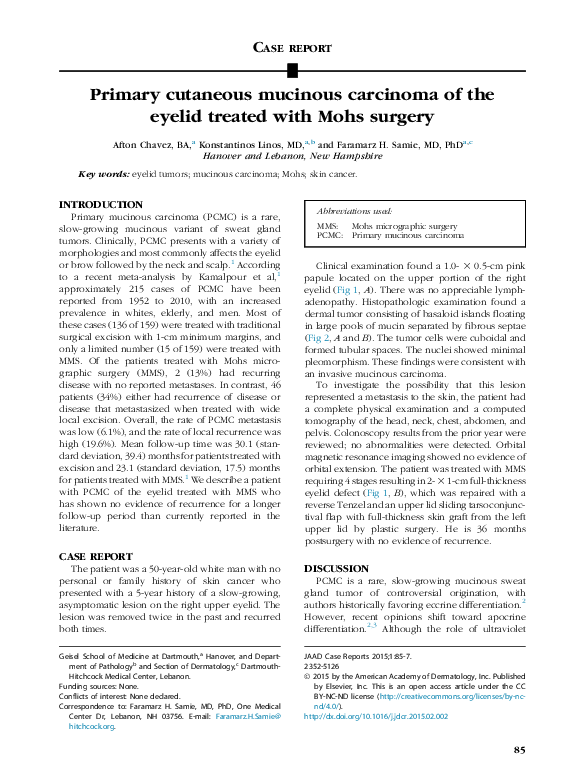 (PDF) Primary Cutaneous Mucinous Carcinoma of Eyelid (PCMC) -A Rare ...
