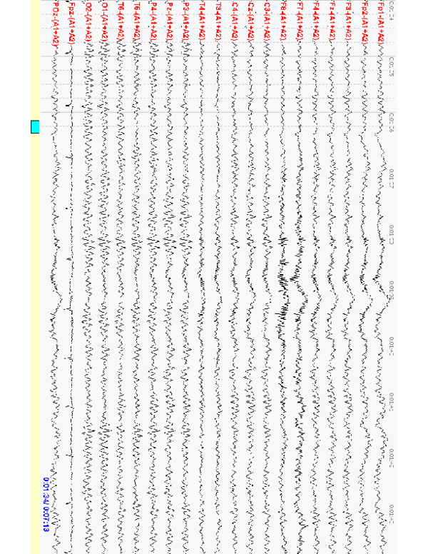 (PDF) Ocular Extramission