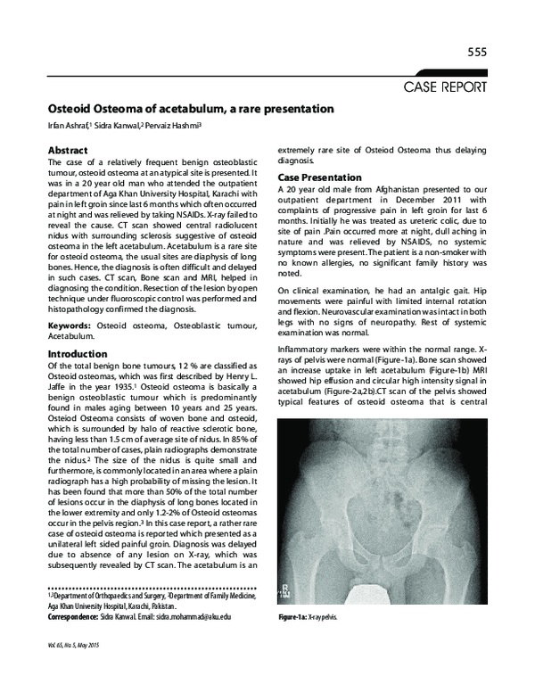 (PDF) Osteoid Osteoma of acetabulum, a rare presentation