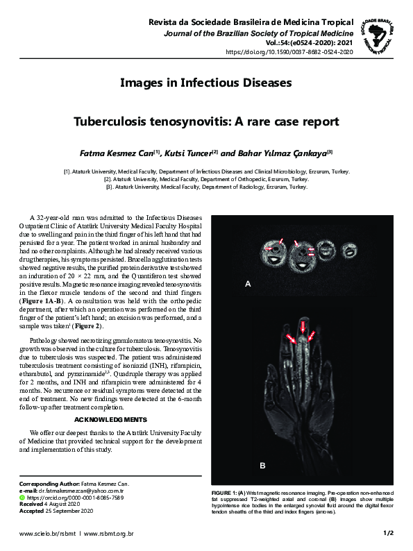 (PDF) Tuberculosis tenosynovitis A rare case report bahar yılmaz