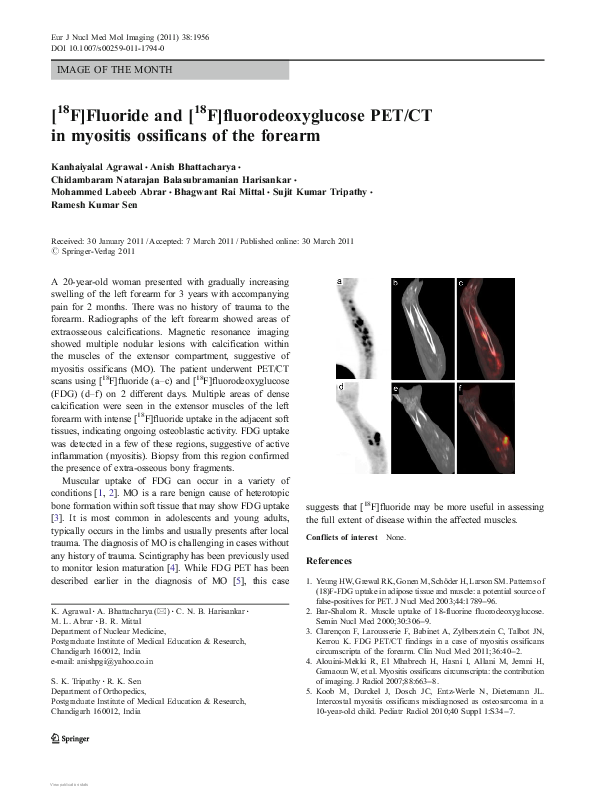 (PDF) [18F]Fluoride and [18F]fluorodeoxyglucose PET/CT in myositis ...