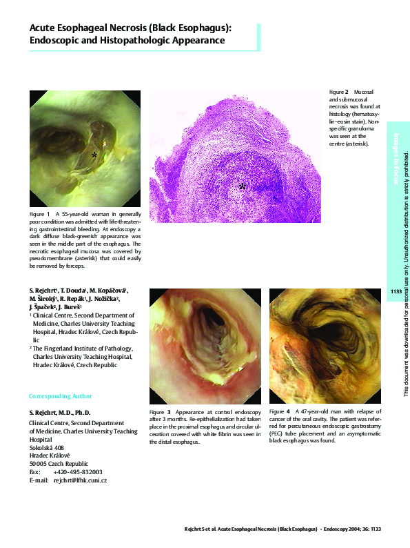 (PDF) Acute Esophageal Necrosis (Black Esophagus) Endoscopic and