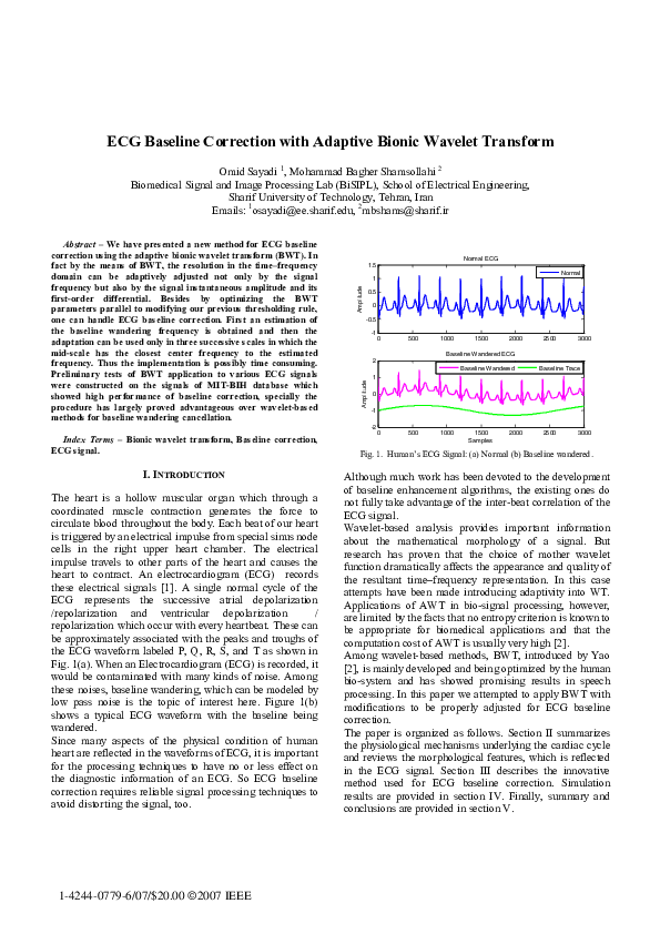 (PDF) ECG baseline correction with adaptive bionic wavelet transform