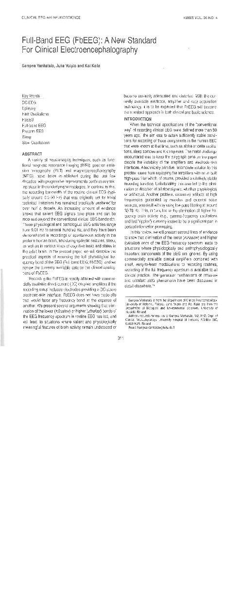 (PDF) Full-band EEG (fbEEG): a new standard for clinical ...