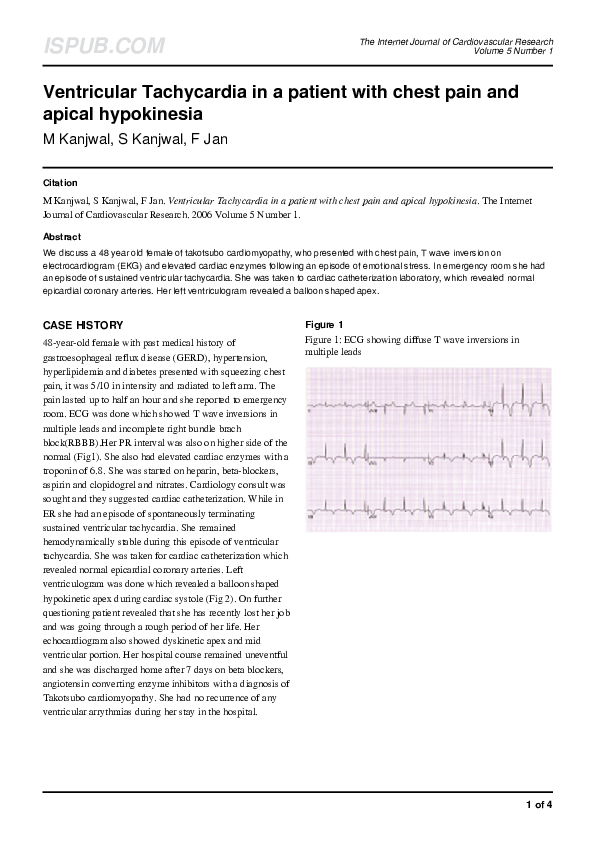 (PDF) Ventricular Tachycardia in a patient with chest pain and apical