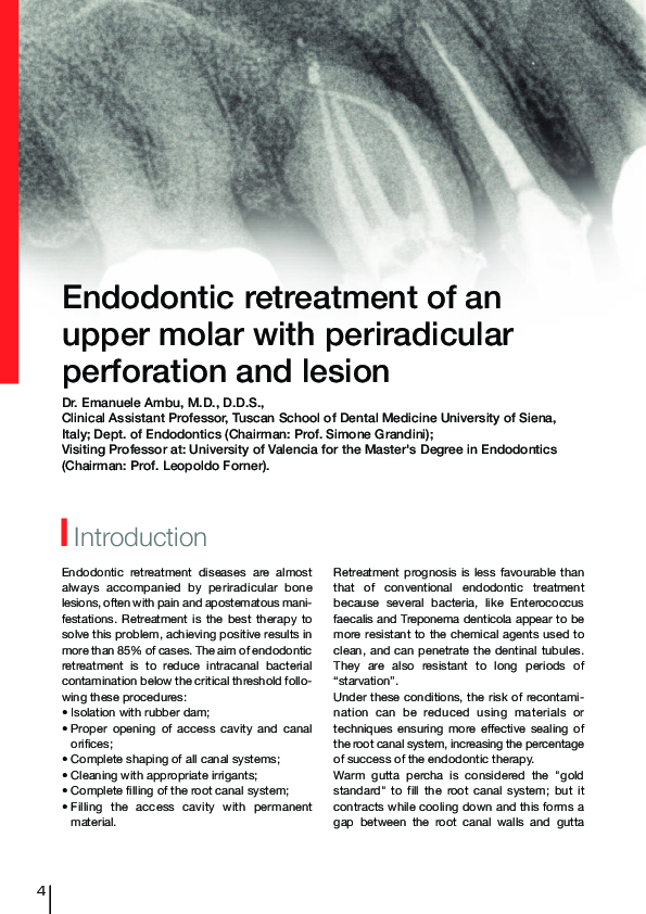 (PDF) Endodontic retreatment of an upper molar with periradicular