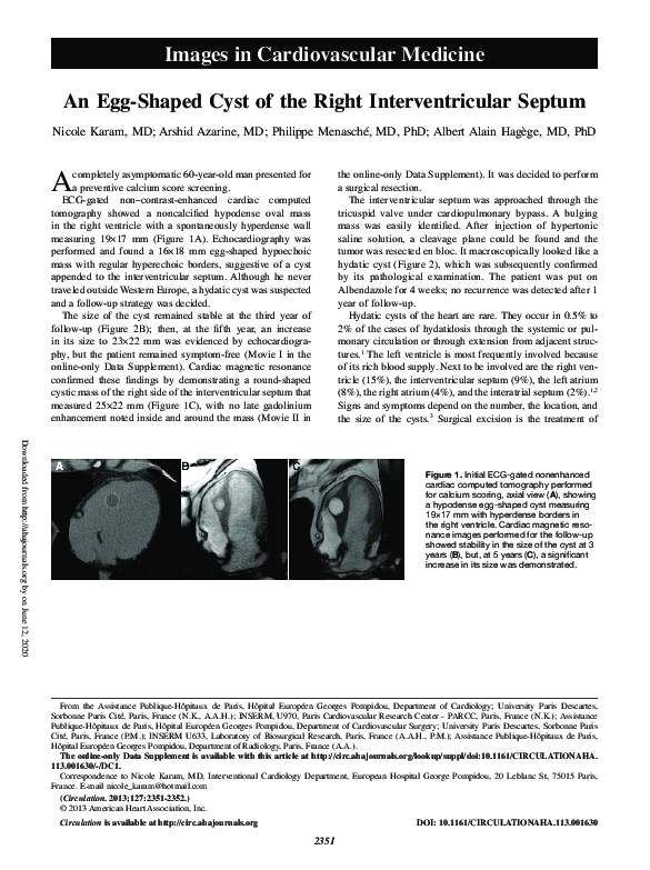 (PDF) An Egg-Shaped Cyst of the Right Interventricular Septum