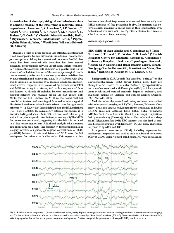 (PDF) EEGfMRI of sleep spindles and at 3 Tesla T. Lund