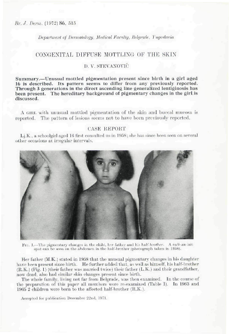 (PDF) Congenital Diffuse Mottling of the Skin