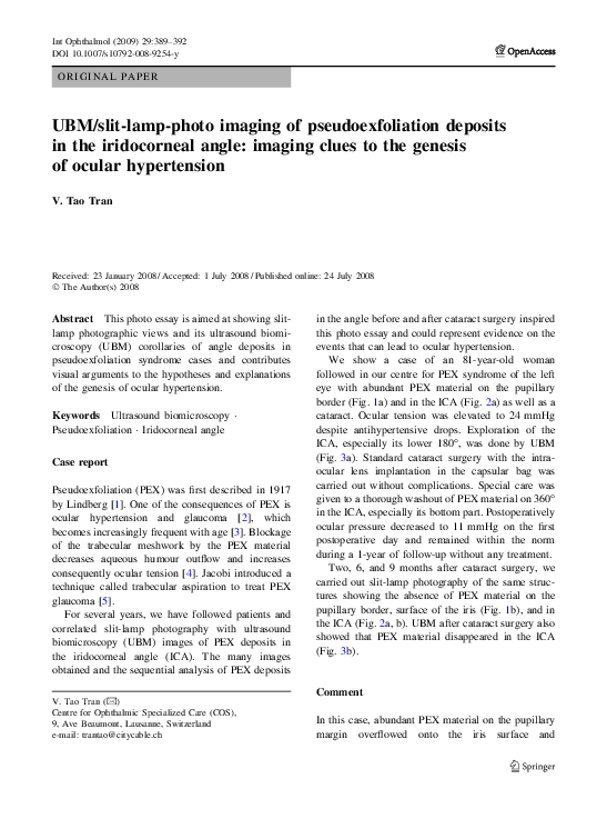(PDF) UBM/slitlampphoto imaging of pseudoexfoliation