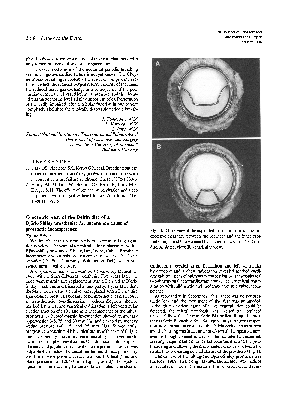 (PDF) Concentric wear of the Delrin disc of a Björk-Shiley prosthesis ...