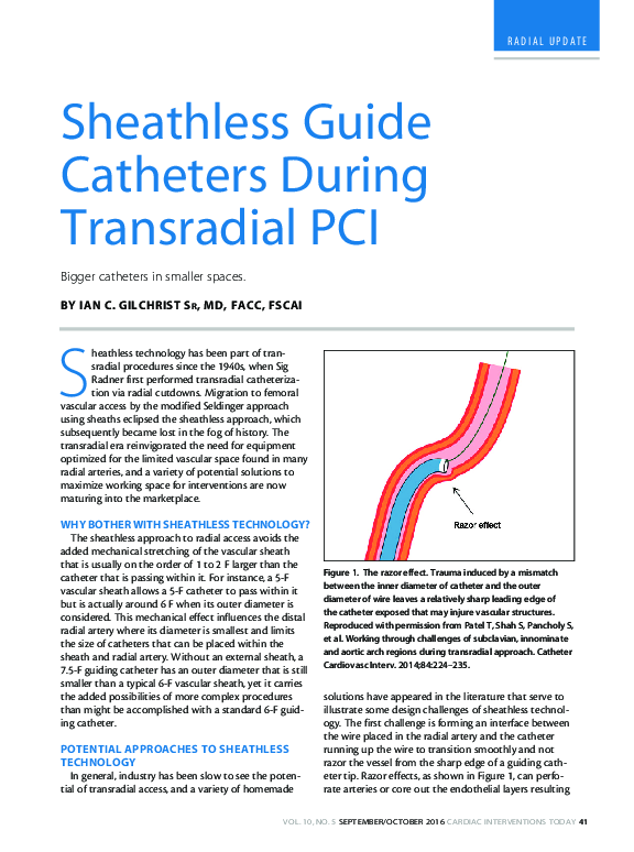 (PDF) Sheathless Guide Catheters During Transradial PCI Ian Gilchrist