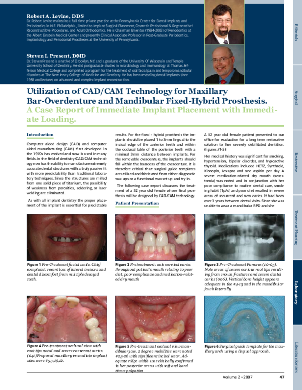(PDF) Utilization of CAD/CAM Technology for Maxillary Bar-Overdenture ...