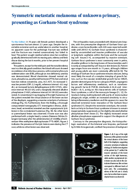 (PDF) Symmetric metastatic melanoma of unknown primary, presenting as ...