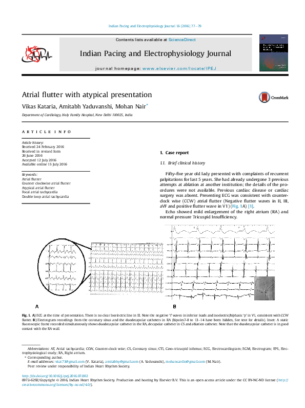 (PDF) Atrial flutter with atypical presentation