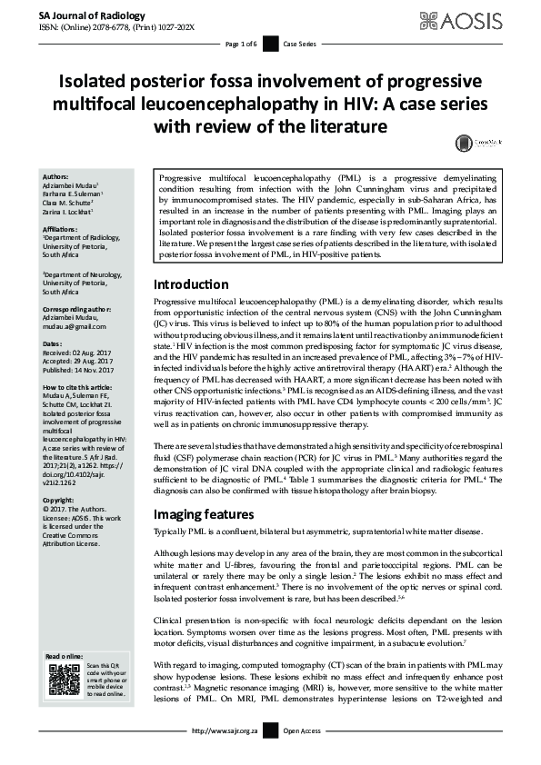 (PDF) Isolated posterior fossa involvement of progressive multifocal ...