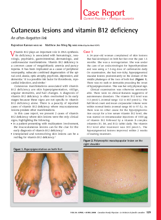 B12 Deficiency Skin Rash