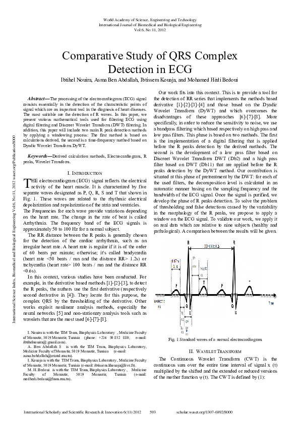 (PDF) Comparative Study of QRS Complex Detection in ECG