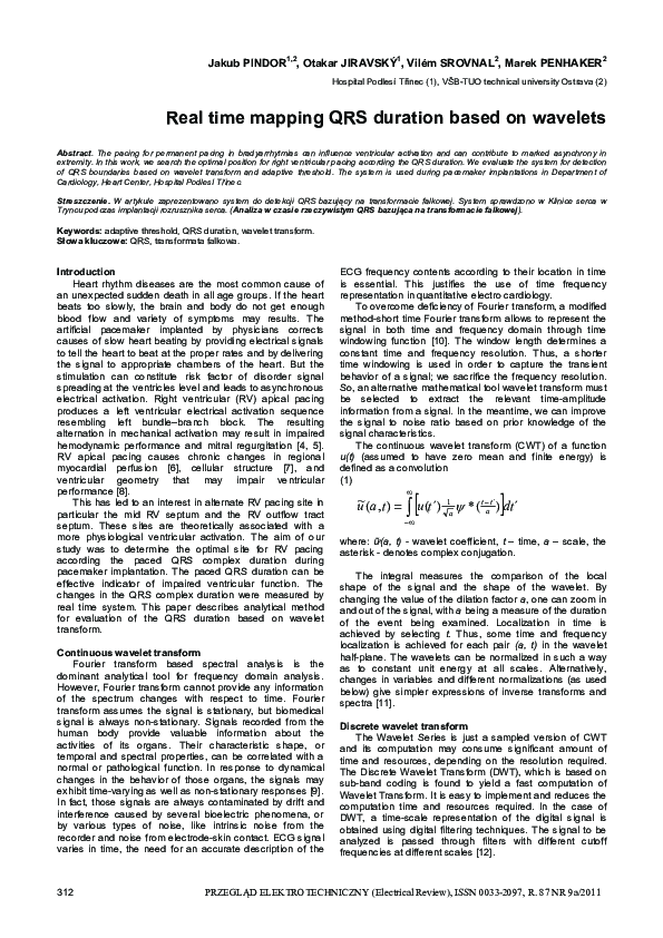 (PDF) Real time mapping QRS duration based on wavelets