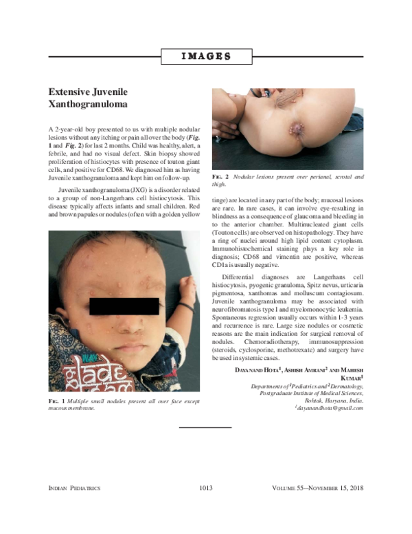 (PDF) Extensive Juvenile Xanthogranuloma