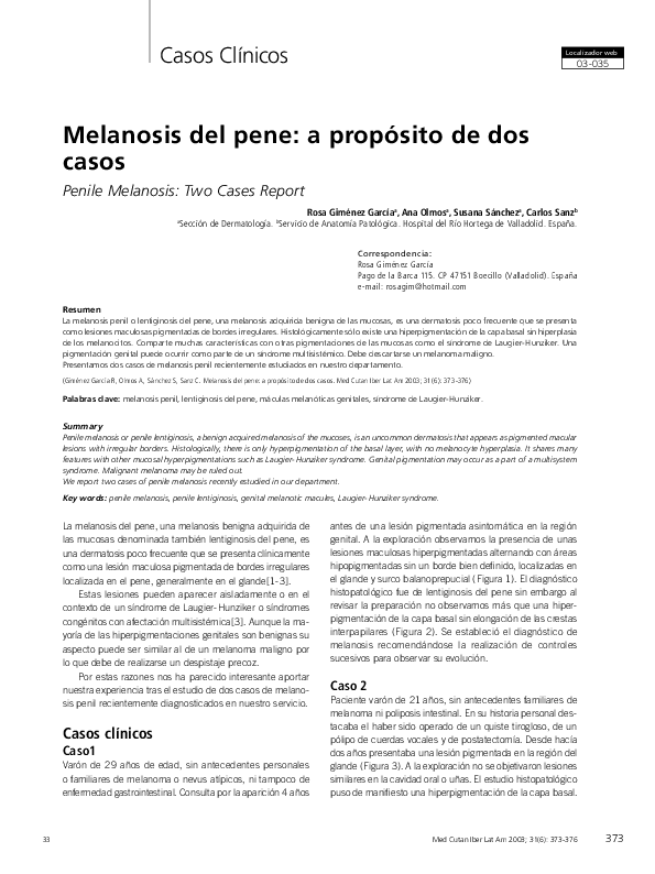 melanotan 2 cream Melanotan II (Tan Jabs): Why They're Not Worth The Risk