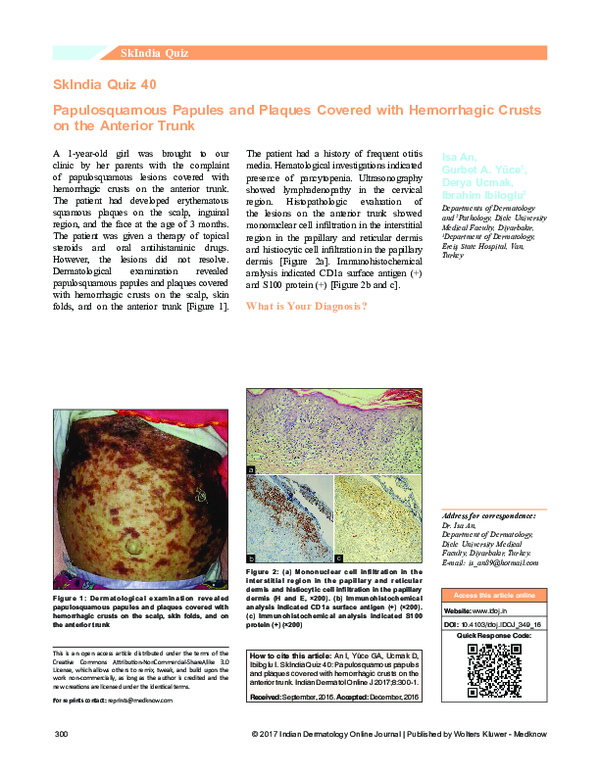 (PDF) SkIndia Quiz 40: Papulosquamous papules and plaques covered with ...