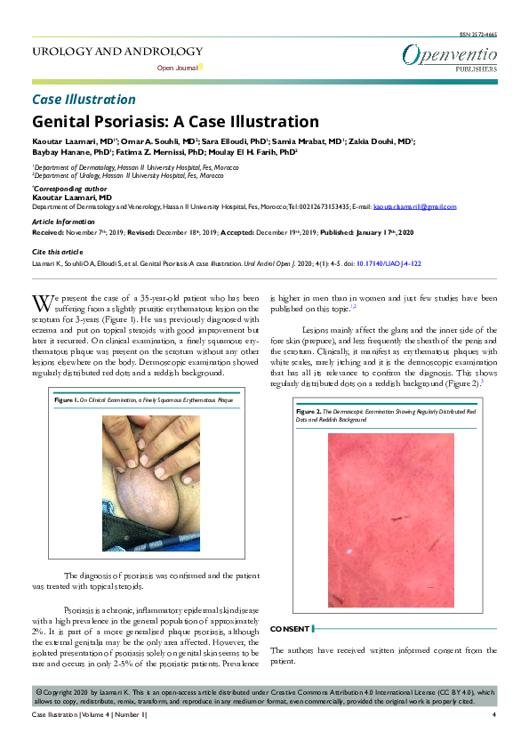 (PDF) Genital Psoriasis: A Case Illustration