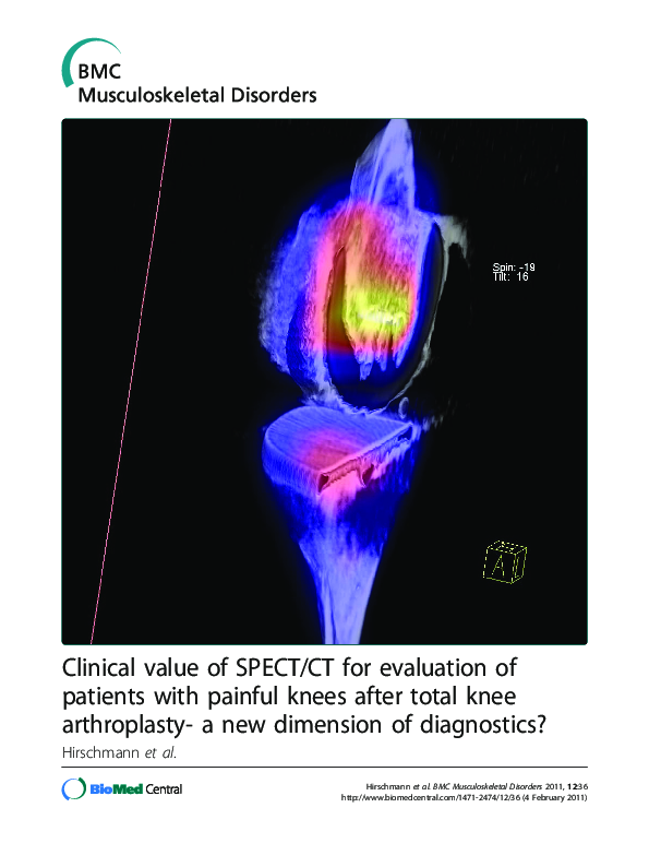 (PDF) Clinical value of SPECT/CT for evaluation of patients with ...