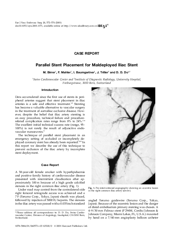 (PDF) Parallel Stent Placement for Maldeployed Iliac Stent