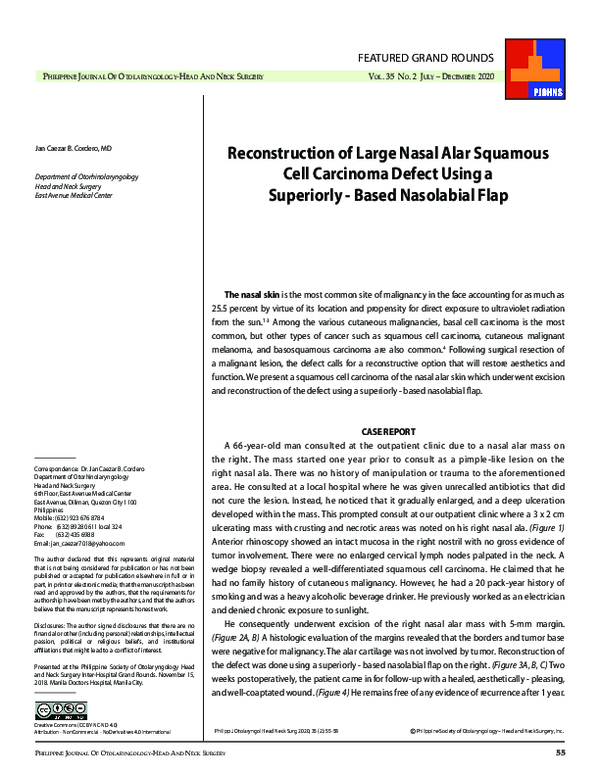 Reconstruction of Large Nasal Alar Squamous Cell Carcinoma Defect Using a Superiorly - Based Nasolabial Flap