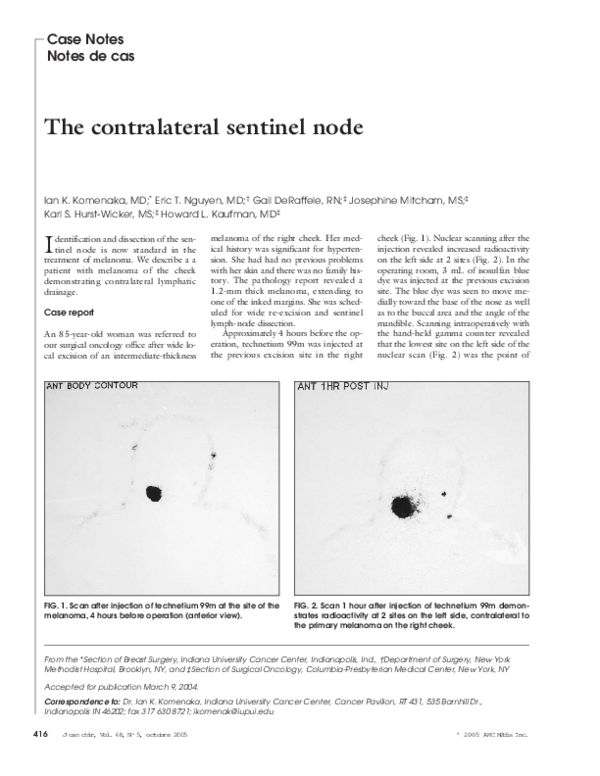 (PDF) The contralateral sentinel node