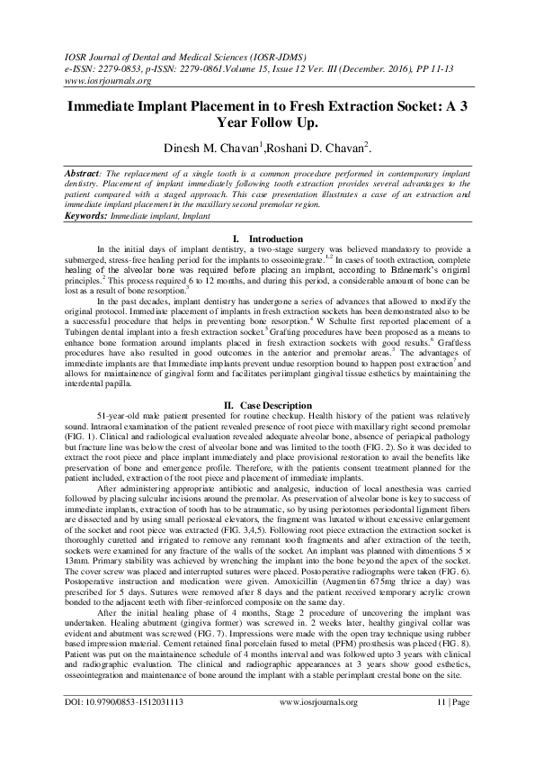 (PDF) Immediate Implant Placement in to Fresh Extraction Socket : A 3 ...
