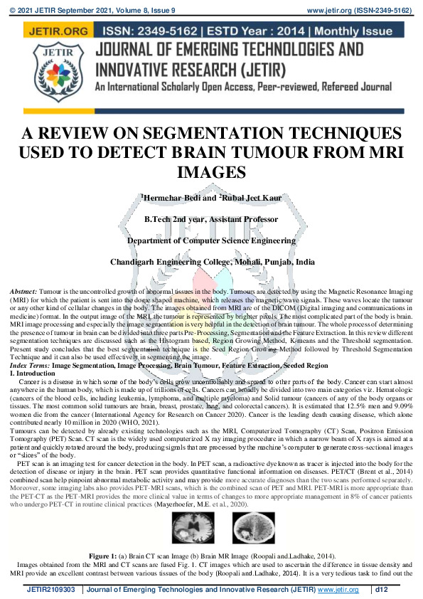 (PDF) A REVIEW ON SEGMENTATION TECHNIQUES USED TO DETECT BRAIN TUMOUR ...
