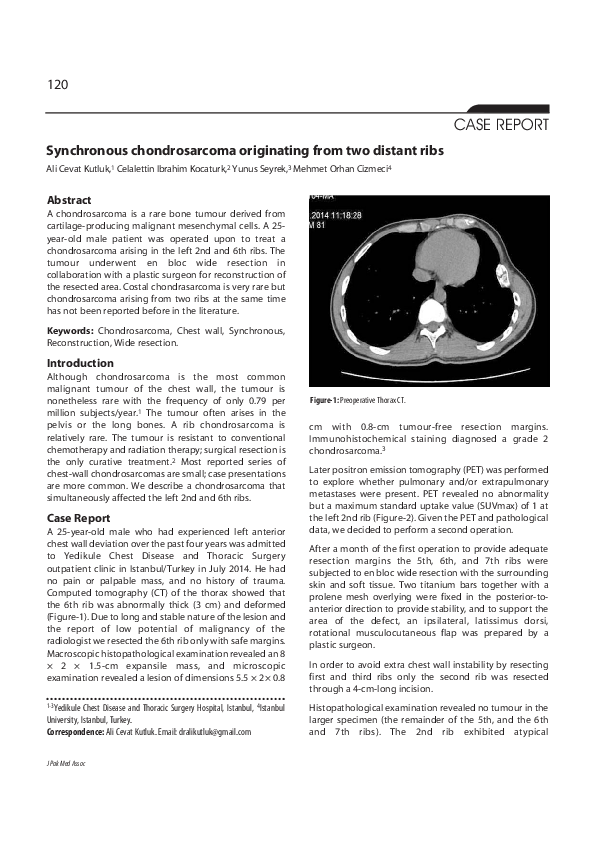 (PDF) Synchronous chondrosarcoma originating from two distant ribs