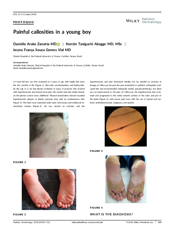 (PDF) Painful callosities in a young boy