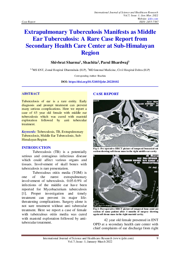 (PDF) Extrapulmonary Tuberculosis Manifests as Middle Ear Tuberculosis ...
