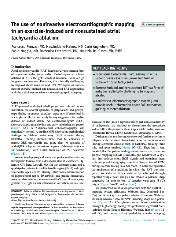 (PDF) The use of noninvasive electrocardiographic mapping in an ...