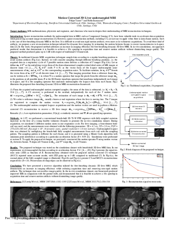(PDF) Motion Corrected 3D Liver undersampled MRI