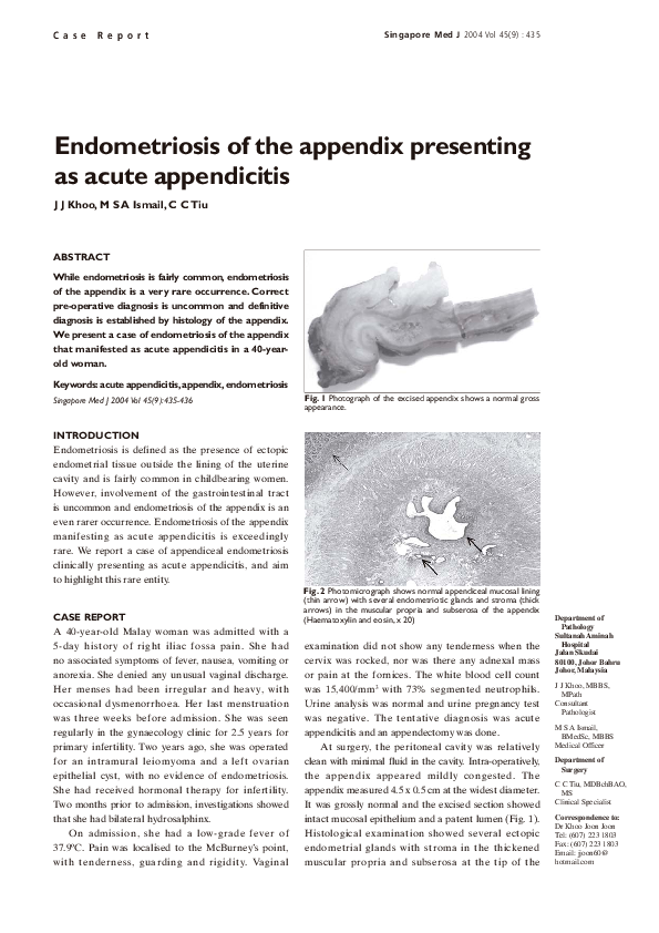 (PDF) Endometriosis of the appendix presenting as acute appendicitis