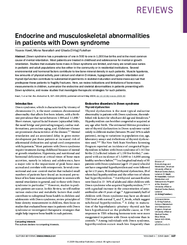 (PDF) Endocrine and musculoskeletal abnormalities in patients with Down ...