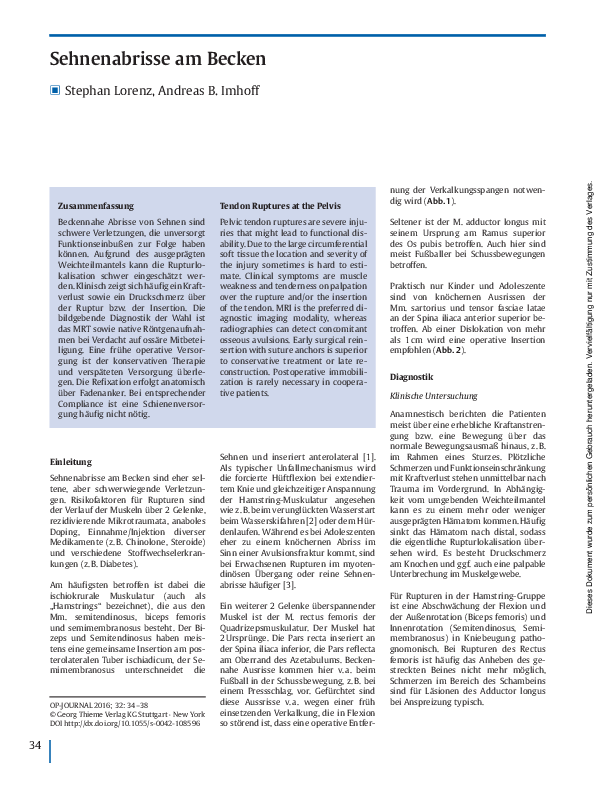 PDF) Rupturen großer Sehnen | Volker Grosser - Academia.edu